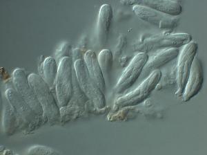 Aulographum hederae asci and ascospores