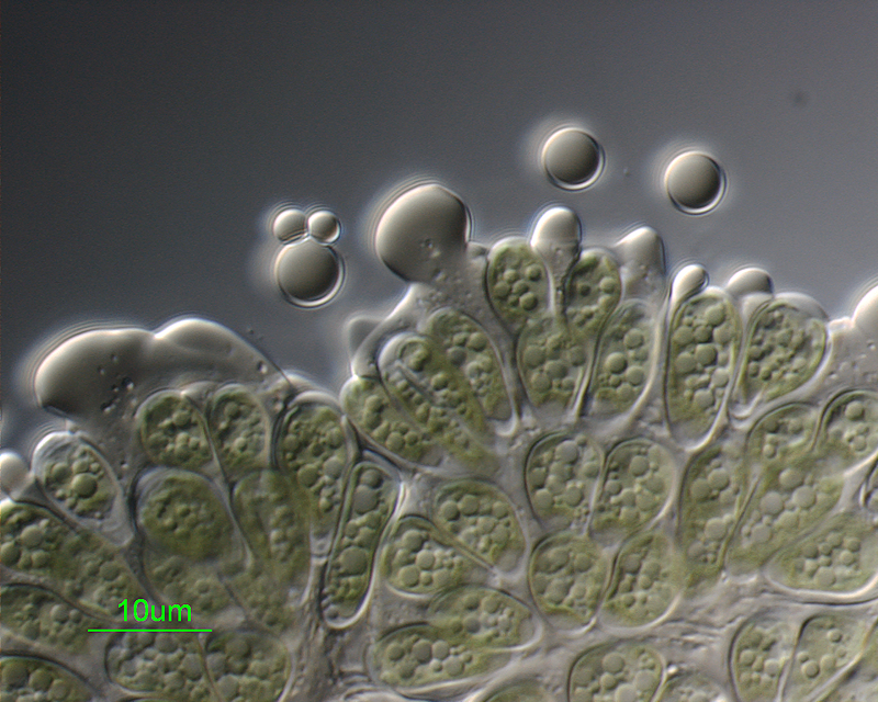Micrograph of Botryococcus braunii.