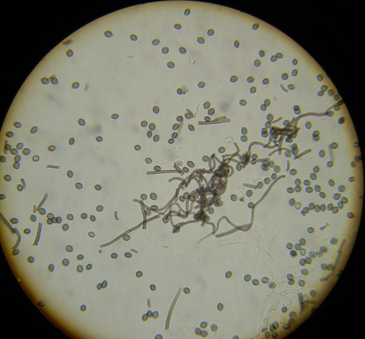 Chaetomium ascospores.
