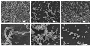 Scanning electron microscopy images of C. lusitaniae