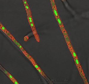 Photo of Cochliobolus lunatus m118 v1.0