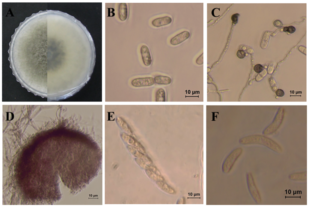 Photo of Colletotrichum fructicola Nara gc5