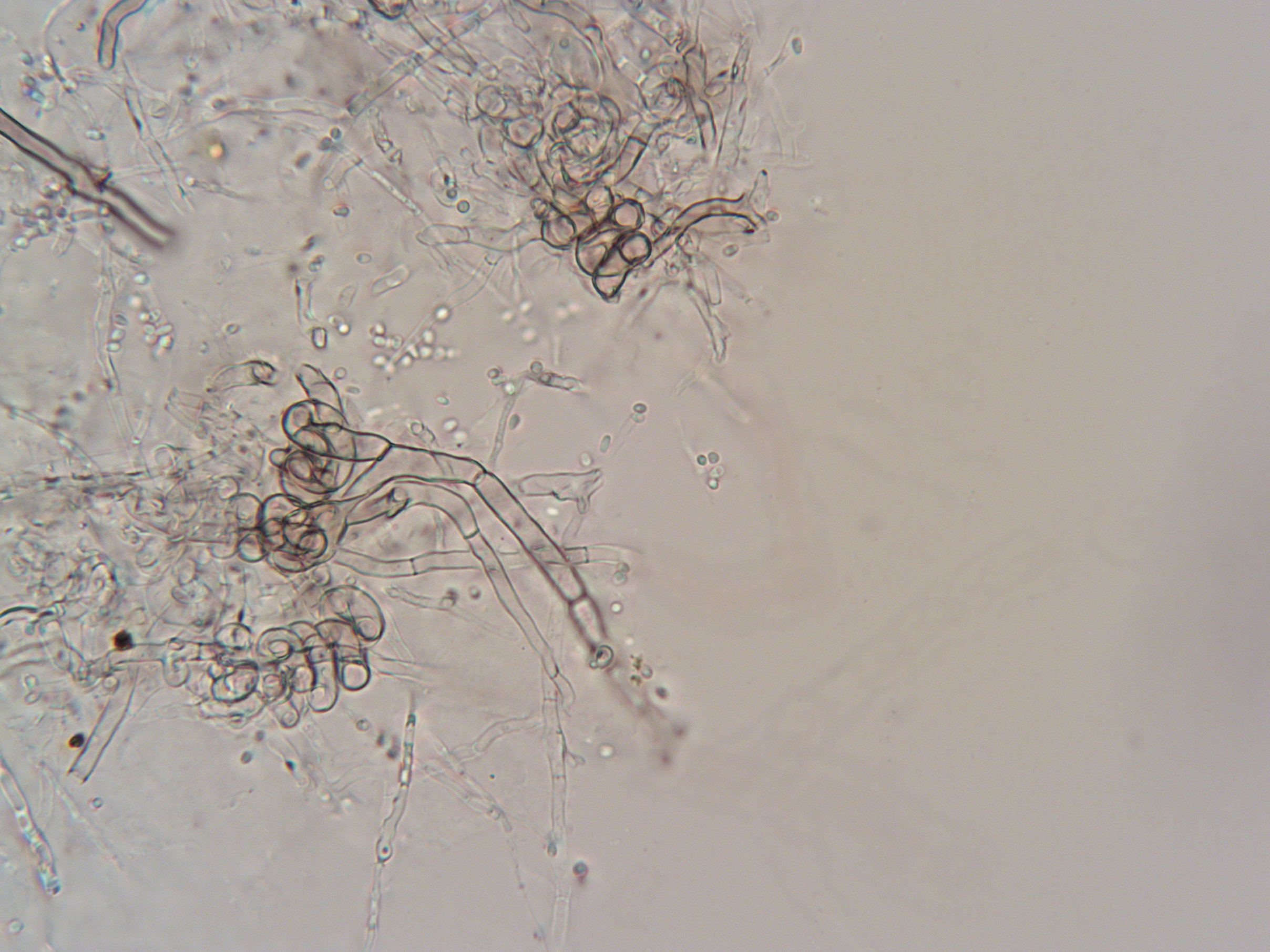 Copromyces sp. CBS 386.78