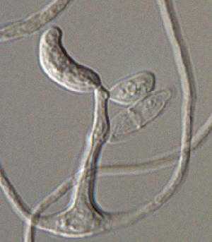 Conidiophores of Dissoconium aciculare, giving rise to conidia.