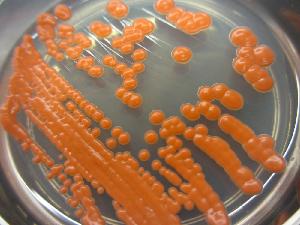 Erythrobasidium hasegawianum