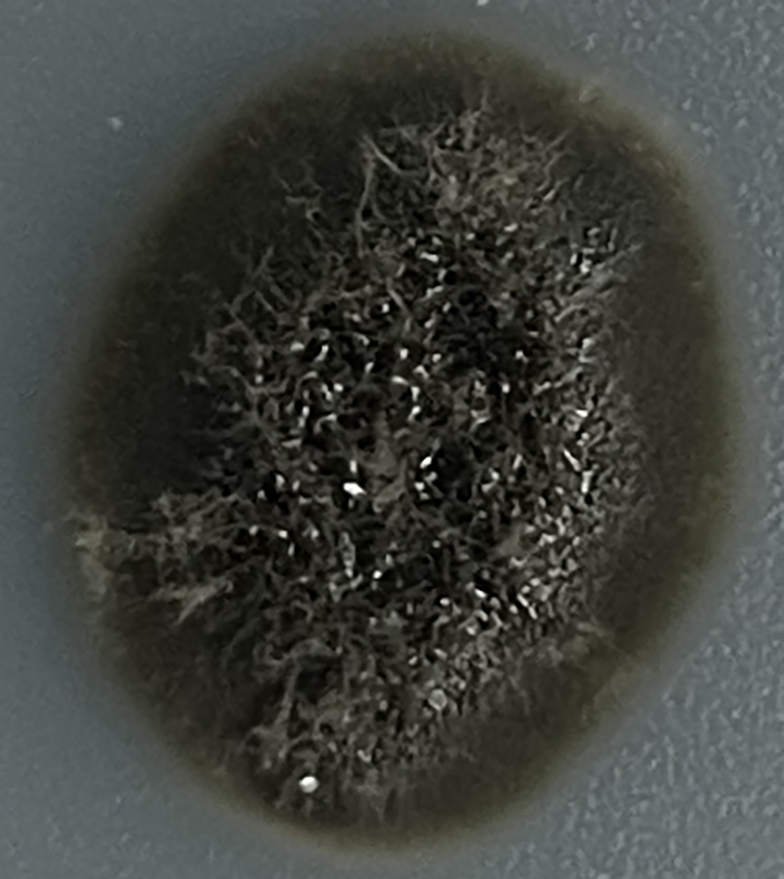 Exophiala sp. D403-30F growing in the lab.
