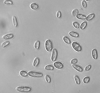 Conidia in culture of Czapek-Dox medium, as viewed under a light microscope.