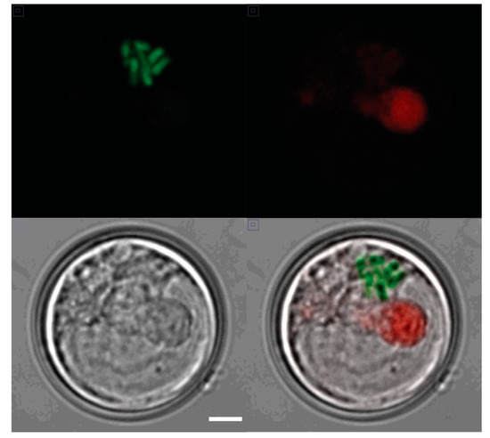 Condensed chromosomes in an interphase S. kawagutii cell. A
confocal image of a single cell taken in (upper left) the green
channel (PI staining of chromosomes), (upper right) the red channel
(natural chlorophyll fluorescence), and (lower left) a DIC
(Nomarski) image (scale bar 1 µm for all panels). A merged
image is shown in the lower right. Image from <a href="https://doi.org/10.3390/microorganisms7080261">Zaheri et al</a> under CC-BY 4.0