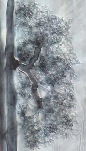 Glomus intraradices