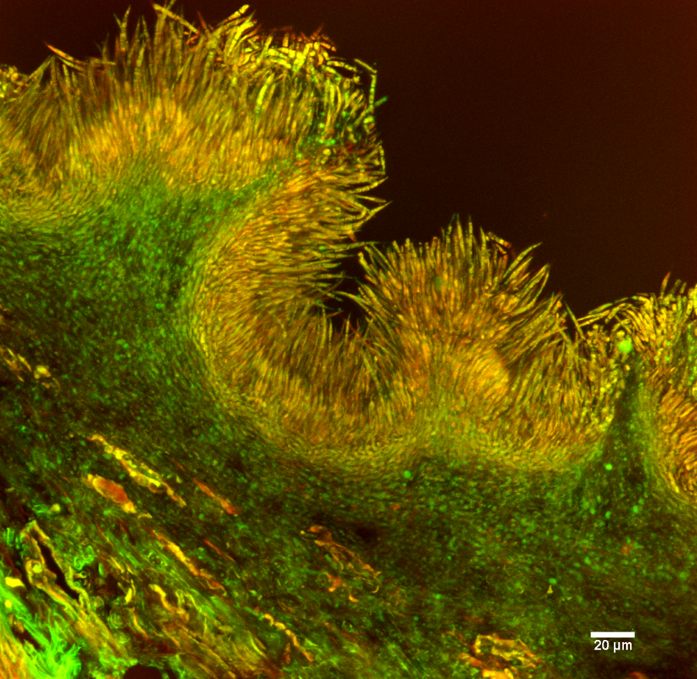 Pycnidia of Gremmeniella abietina lined with conidia colored in orange on this confocal microscopic image.