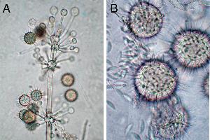 Hesseltinella sporophore apex (a) and sporangiolum (b). Photo credit: Gerald Benny, Department of Plant Pathology, University of Florida, Gainesville, Florida