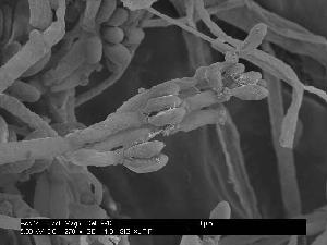 Hypoxylon sp. CI-4A