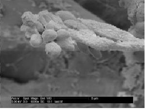Hypoxylon sp. EC38