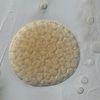 L. corymbifera sporangia. Image by James Scott.
