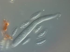 Asci and ascospores.