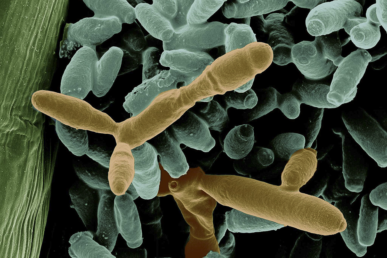M. gruessii cells exhibiting the characteristic airplane structure. Electron micrograph magnification 7500x.
