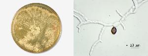 Conidiating colony on MEA and germinating ascopore.
Photos by Don Natvig and Miriam Hutchinson