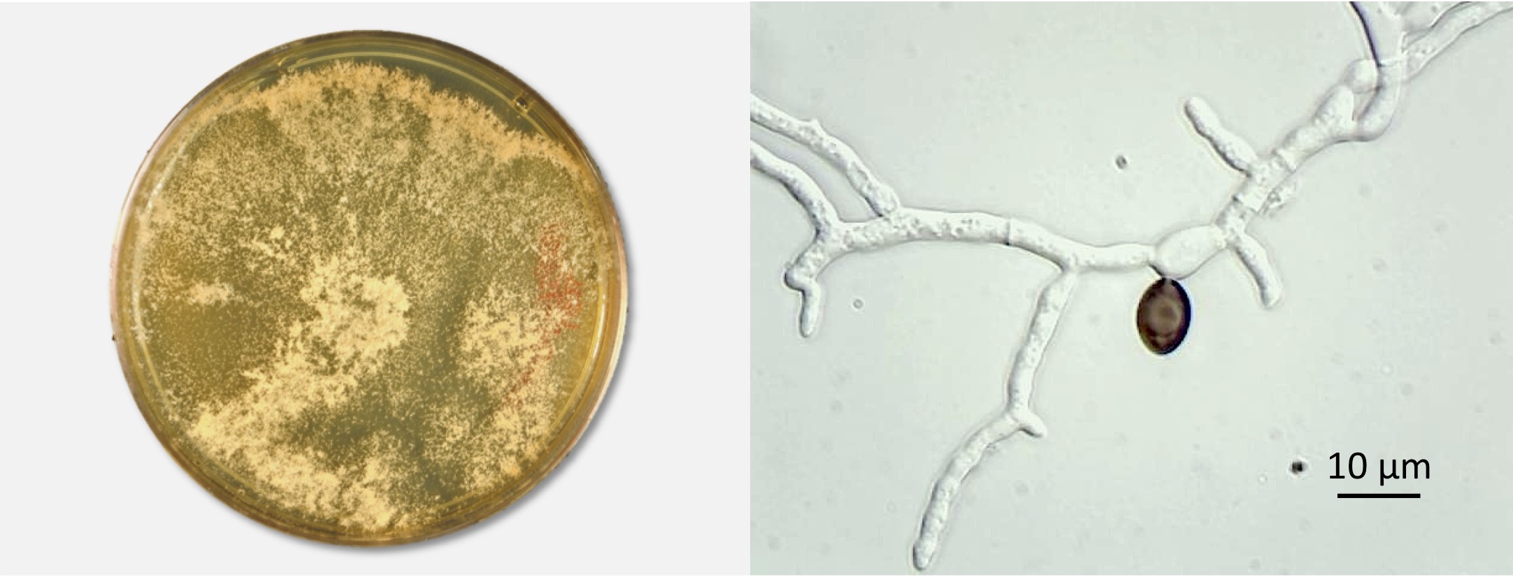 Conidiating colony on MEA and germinating ascopore. Photos by Don Natvig and Miriam Hutchinson