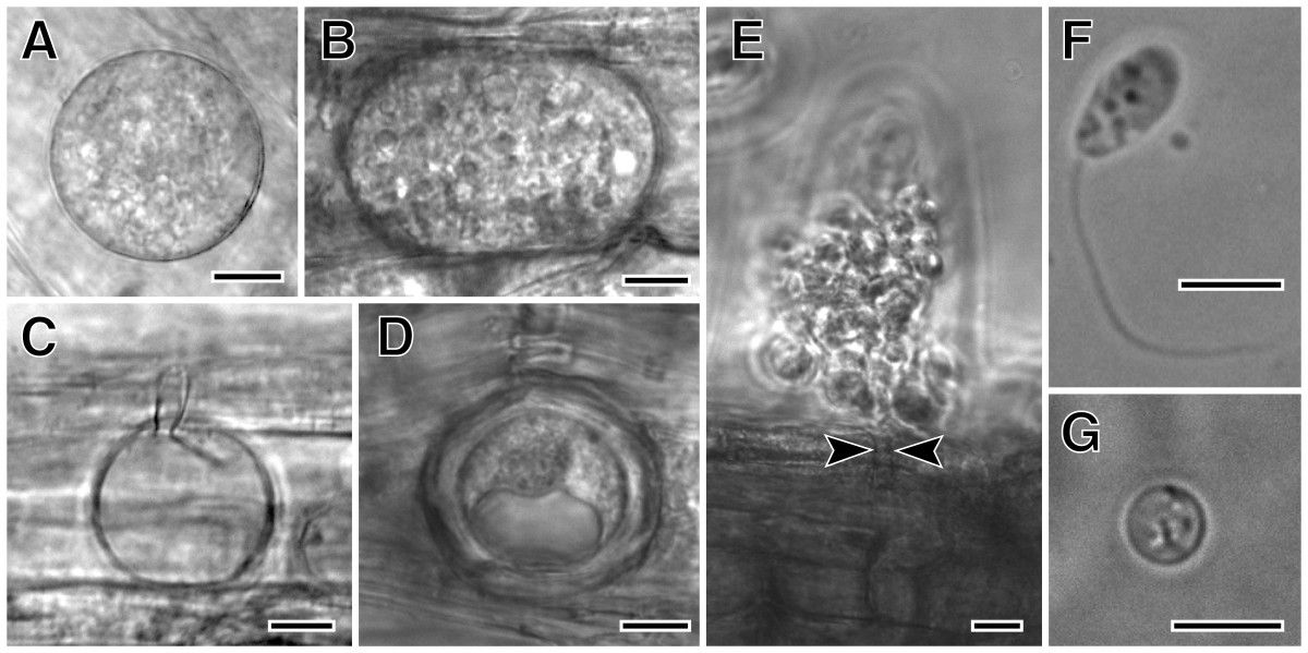 From Sekimoto et al., 2011: Olpidium bornovanus, a unicellular
fungus, is an obligate parasite of plants that reproduces with
flagellated, swimming zoospores. A-B. Vegetative unicellular thalli
in cucumber root cells. Thalli differentiate into sporangia with
zoospores, or into resting spores. C. An empty sporangium, after
zoospore release. D. A thick-walled resting spore. E. Zoospores
being released from a sporangium, showing the sporangium exit tube
(arrowheads). F. A swimming zoospore with a single posterior
flagellum. G. An encysted zoospore. Bars: A-E = 10 μm; F,G = 5
μm. Figures are from <a
href="https://bmcevolbiol.biomedcentral.com/articles/10.1186/1471-2148-11-331">Sekimoto et.
al., 2011</a> used under a <a
href="http://creativecommons.org/licenses/by/2.0/">Creative Commons
Attribution 2.0</a> License.
