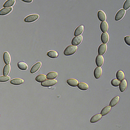 Conidia of Paecilomyces variotii strain CBS 144490. P. variotii produces large numbers of these airborne asexual spores, each of about 10 µm in length. Image provided by Andrew Urquhart.
