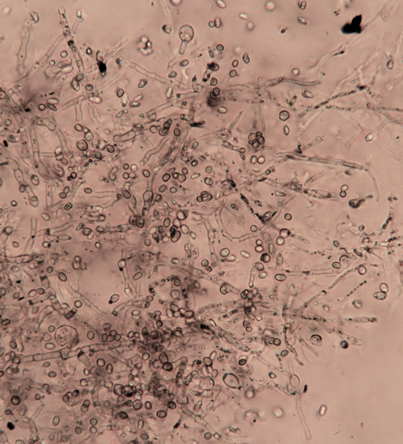 Phialemonium atrogriseum