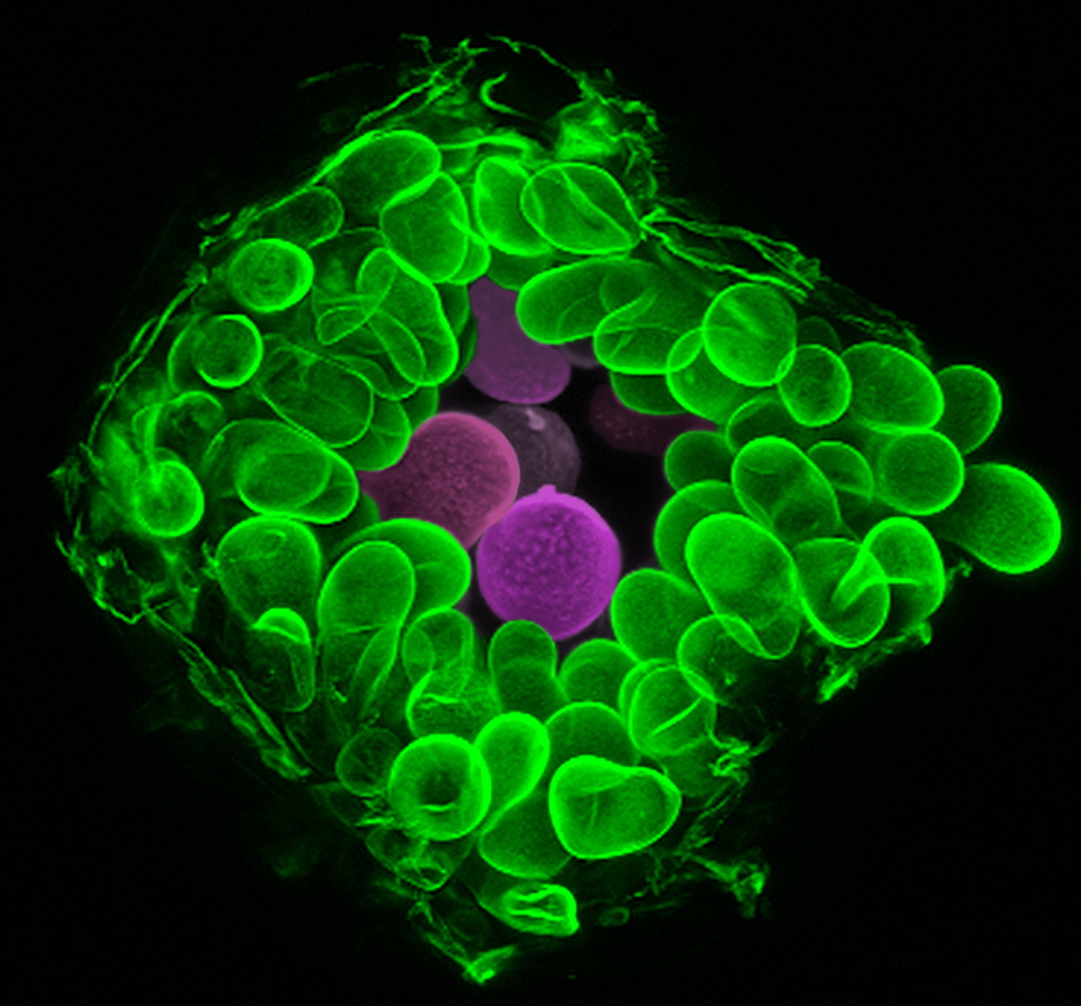 Confocal laser scanning microscopy picture of a uredinium on soybean leaf infected by the rust fungus Phakopsora pachyrhizi.