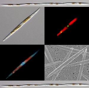 Pseudo-nitzschia multiseries