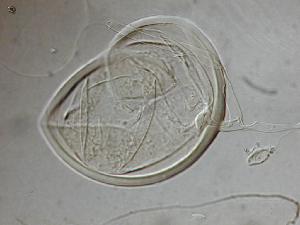 Photo of Rhizophagus diaphanus v1.0