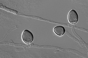 DIC image of R. toruloides teliospores.