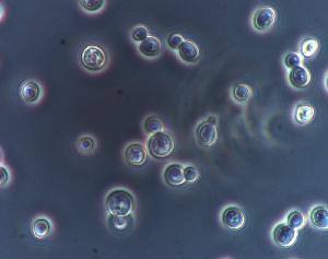 Saccharomyces cerevisiae