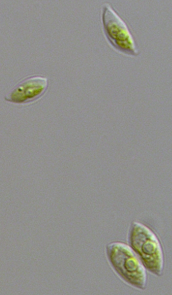 Photo of Scenedesmus obliquus var. DOE0013 v1.0