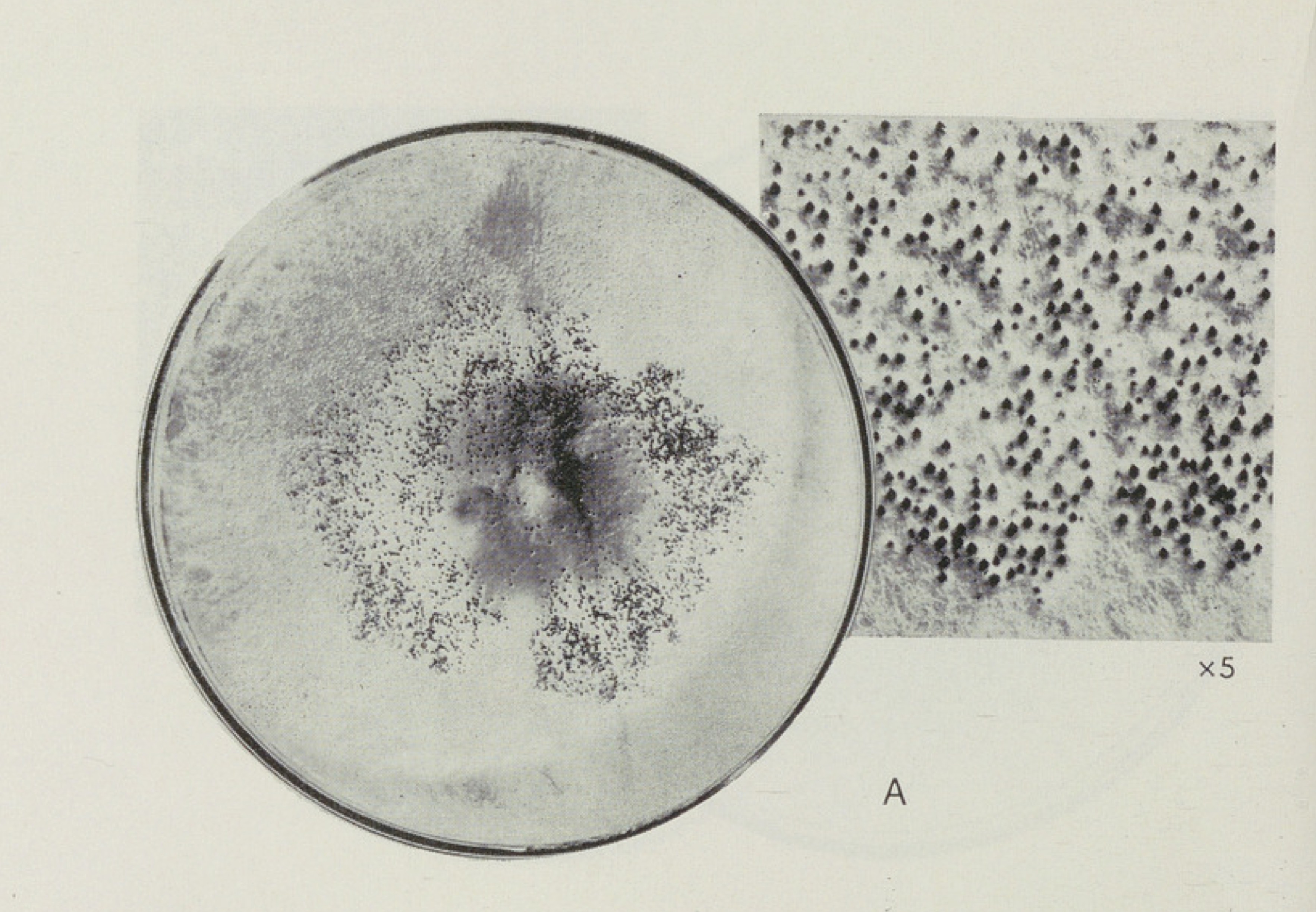 Photograph of Sordaria tomentoalba