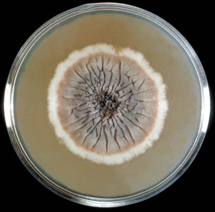Sporothrix schenckii growing on Sabouraud's dextrose agar plate.