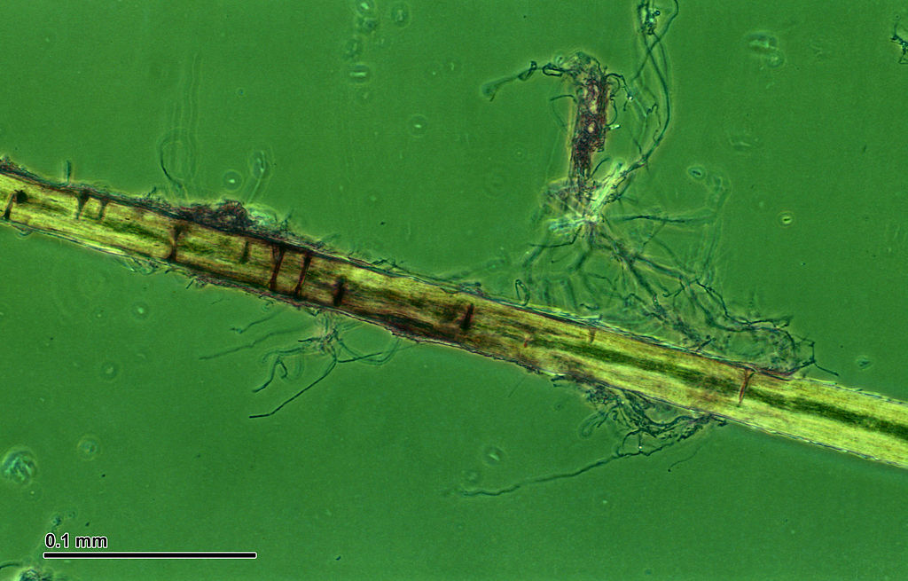 Trichophyton mentagrophytes from a microculture and an
infected hair