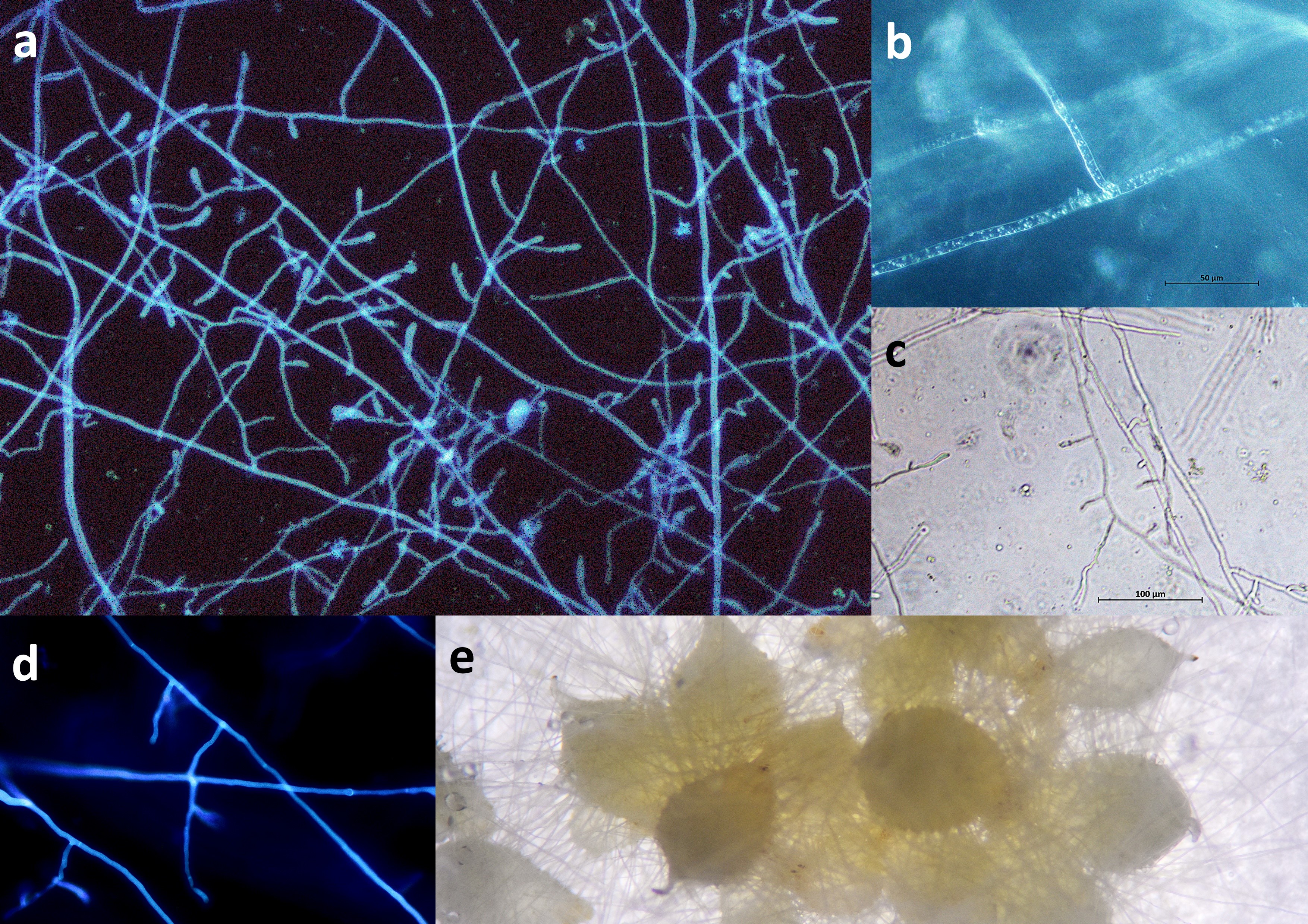 (a and d) Fluorescence microscopy showing Tulasnella helicospora hyphae stained with calcofluor white.  (b and c) Light microscopy images of T. helicospora mycelium grown on agar. (d) orchid protocorms (of Orchis canariensis) germinated symbiotically with T. helicospora OP6.3d. [Photo credit: Jacopo Calevo.]