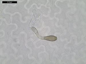 Venturia inaequalis infection of apple leaf (2 days post inoculation) showing germinated conidium and development of early stage, subcuticular stroma.